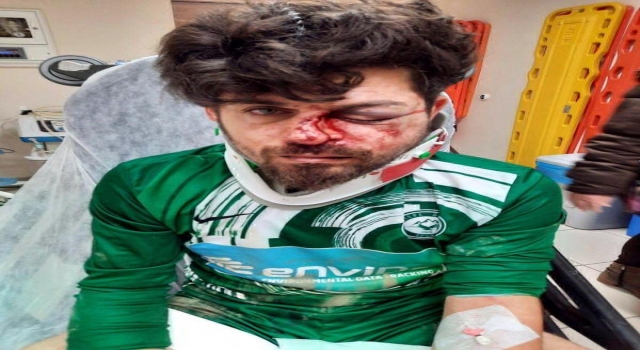 Kırmızı kart gören futbolcu, yerde yatan rakibinin yüzüne tekme atıp yaraladı